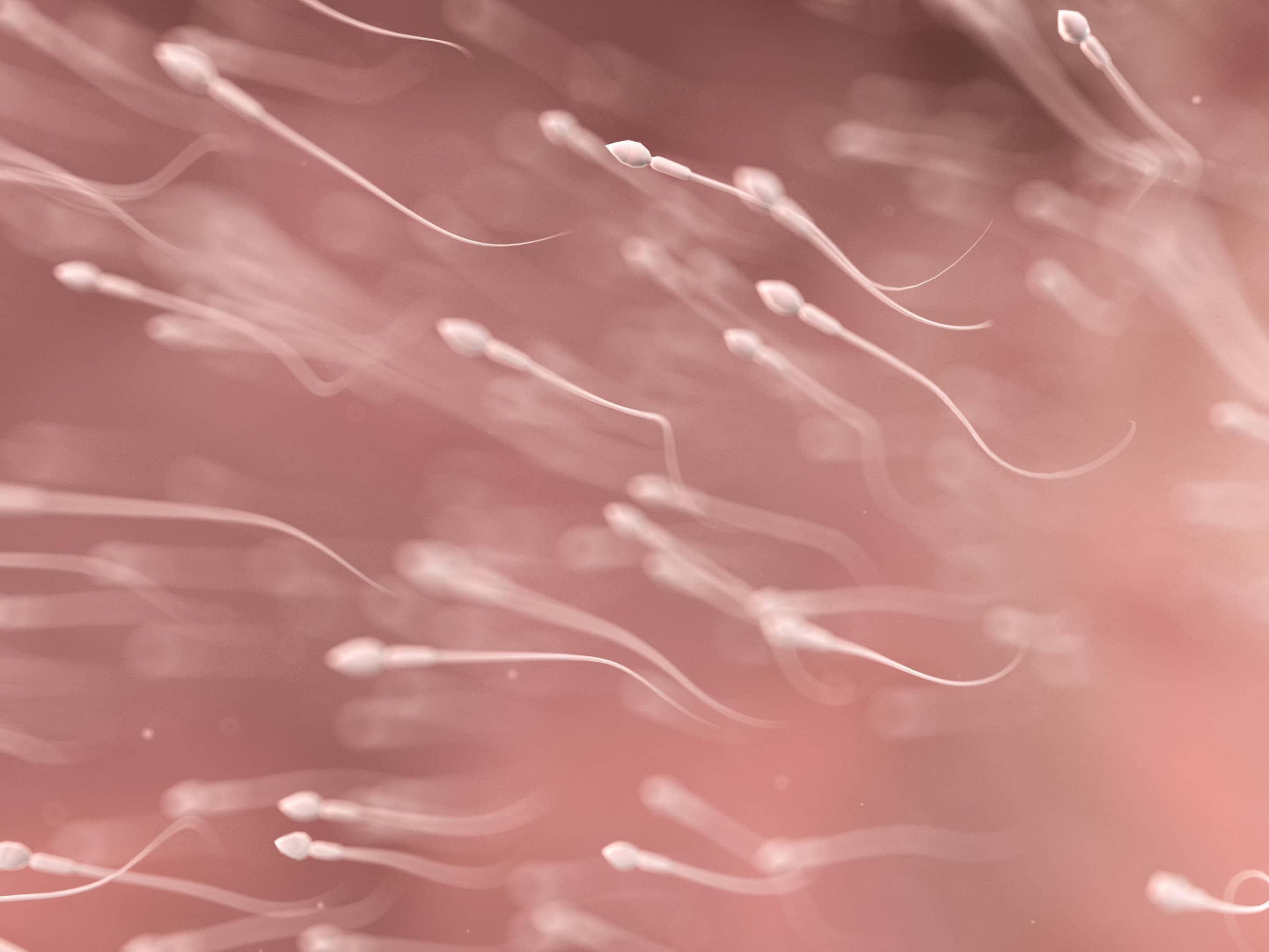 Hematospermia