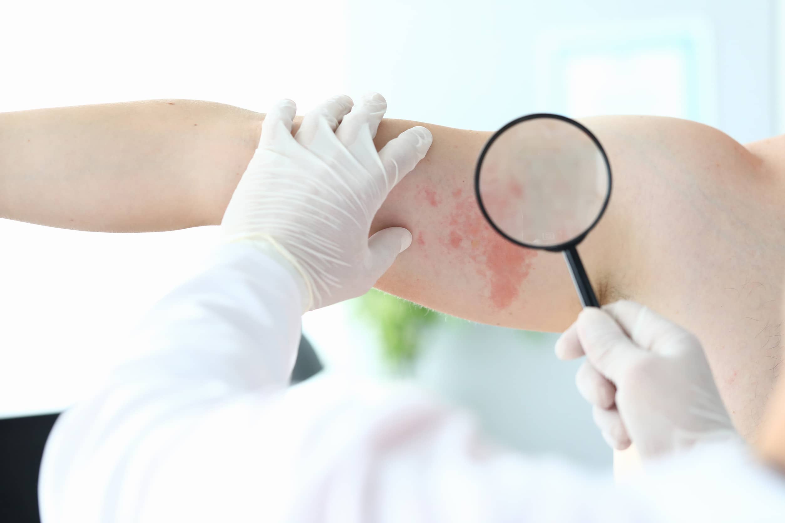 badanie dermatologiczne