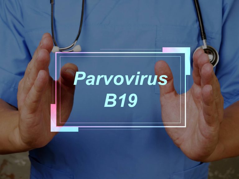 zakażenie parwowirusem B19