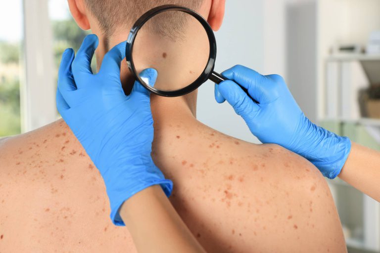 badanie dermatologiczne