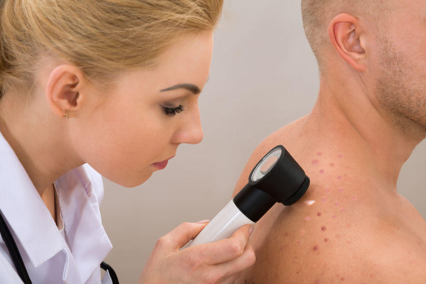 dermatolog ogląda kaszaki