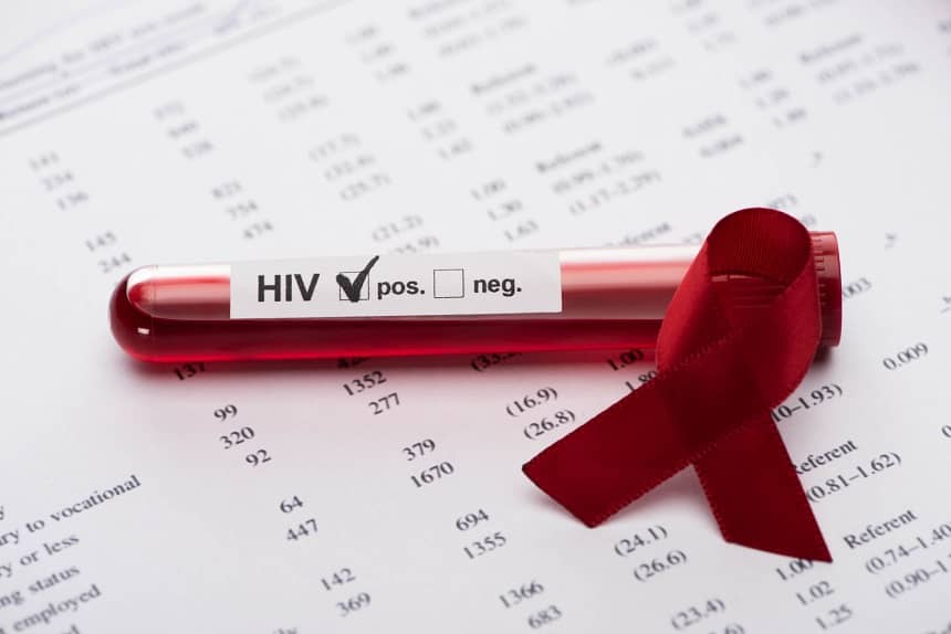 pozytywny wynika na wirusa HIV