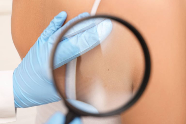 badanie dermatologiczne