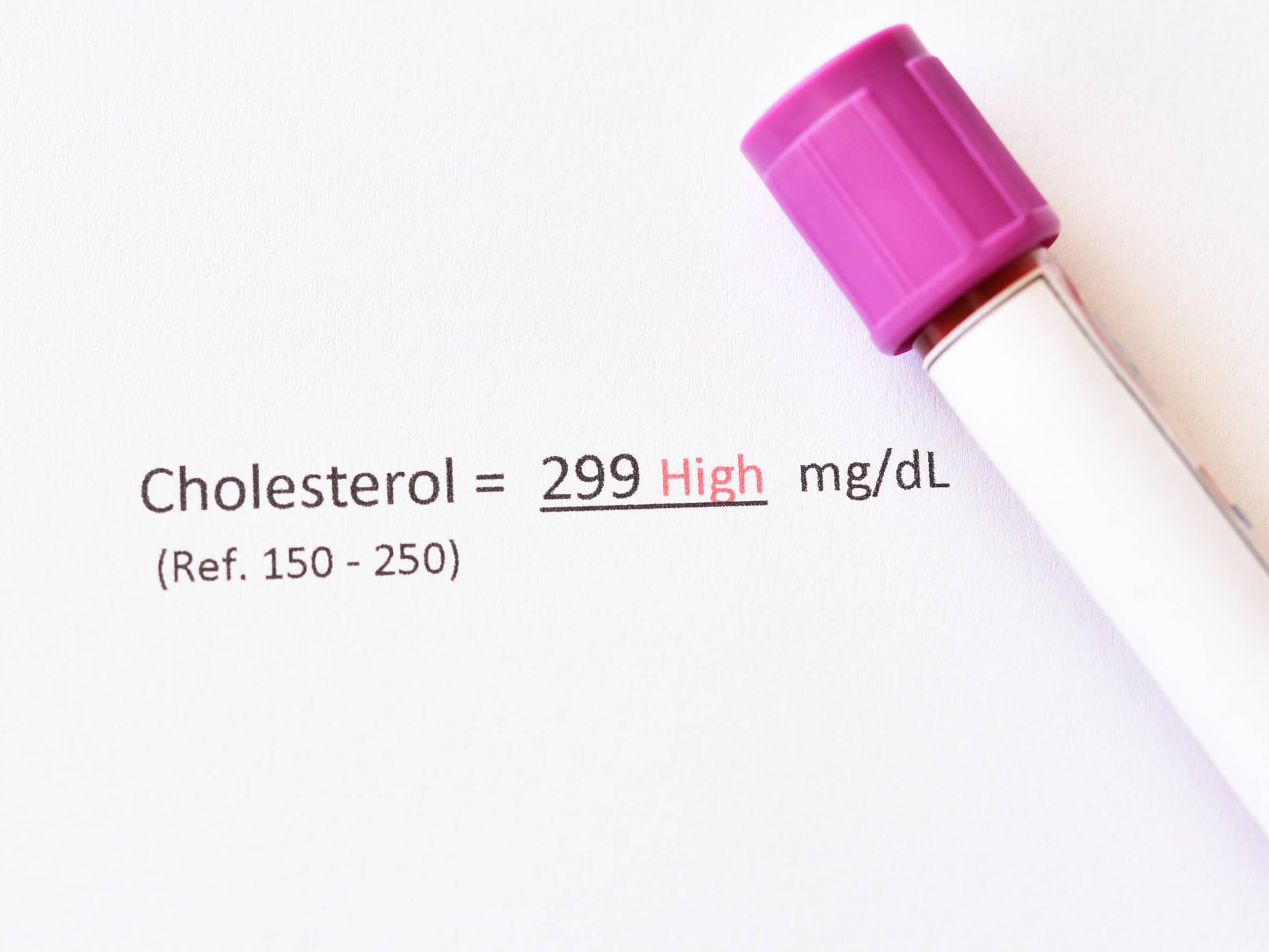wysoki cholesterol