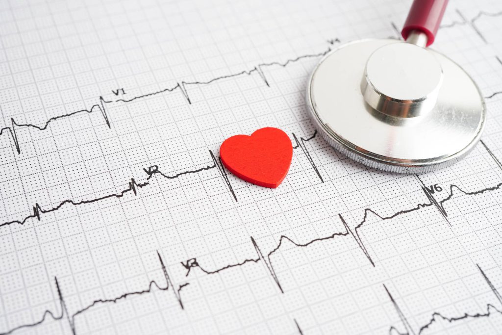 Elektrokardiogram jako diagnostyka arytmii serca