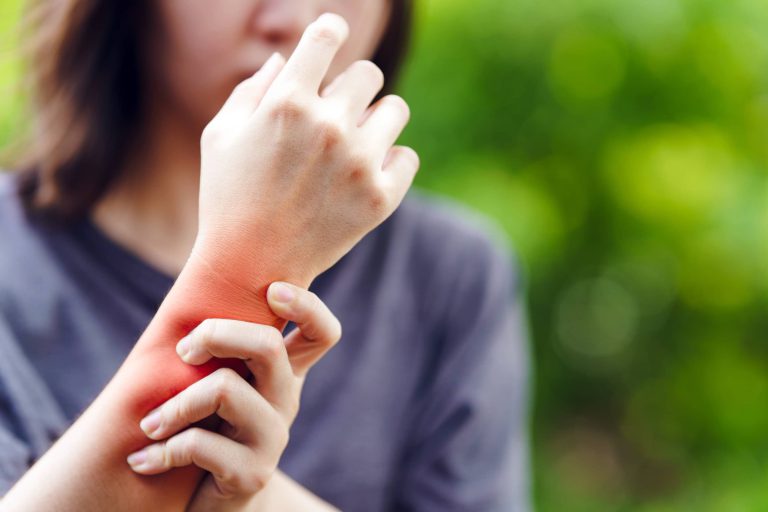 zapalenie pochewek ścięgnistych w obrębie nadgarstka