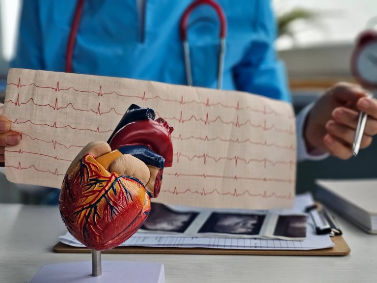 Arytmia serca, dostępne leki