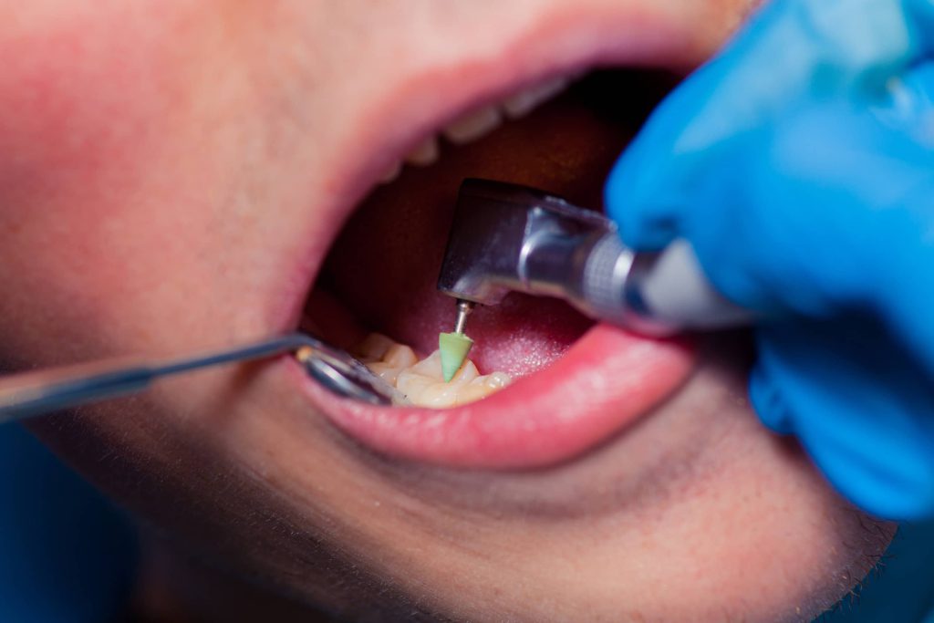 dentysta leczy zęby pacjenta
