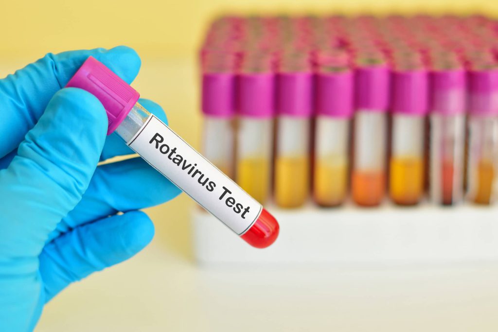 diagnostyka rotawirusów