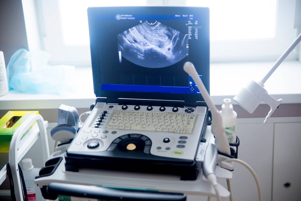 aparat ultrasonograficzny